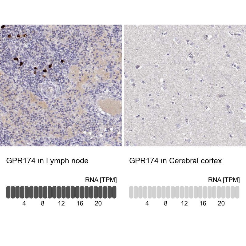 GPR174 Antibody - BSA Free Immunohistochemistry: GPR174 Antibody - BSA Free [NBP1-84667]