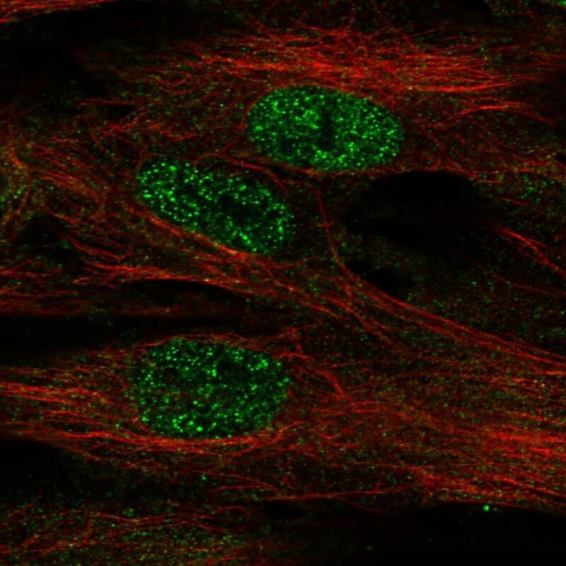 FoxF1 Antibody - BSA Free Immunocytochemistry/ Immunofluorescence: FoxF1 Antibody [NBP1-84670]