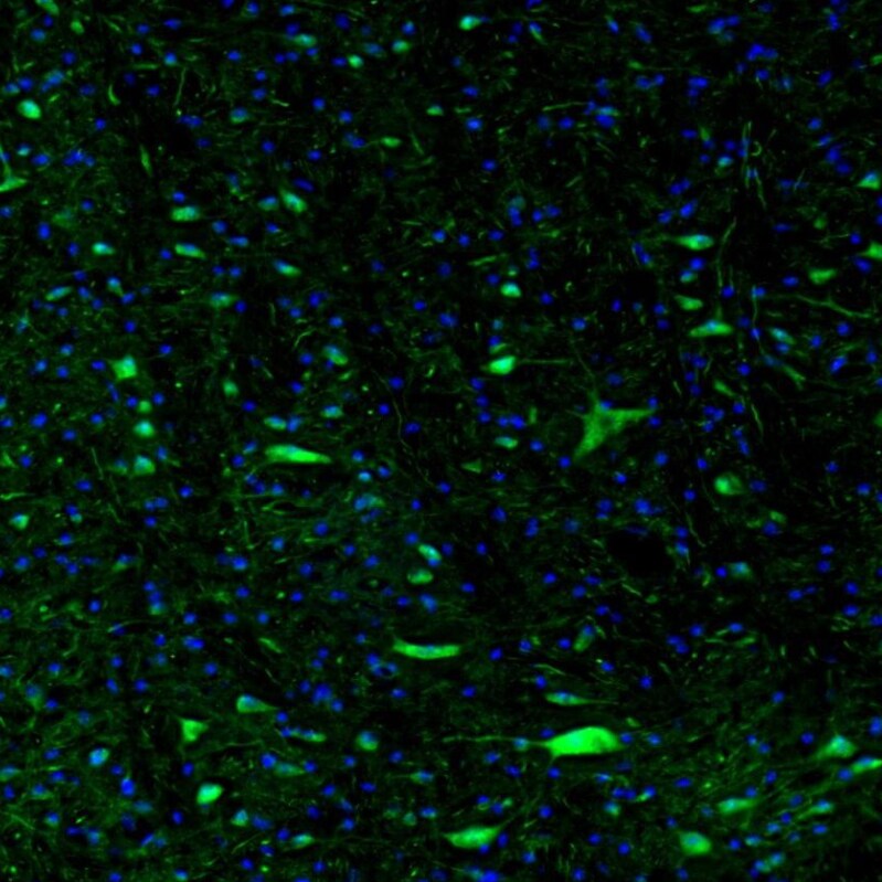 FoxO1/FKHR Antibody - BSA Free Immunohistochemistry: FoxO1/FKHR Antibody - BSA Free [NBP1-84674]