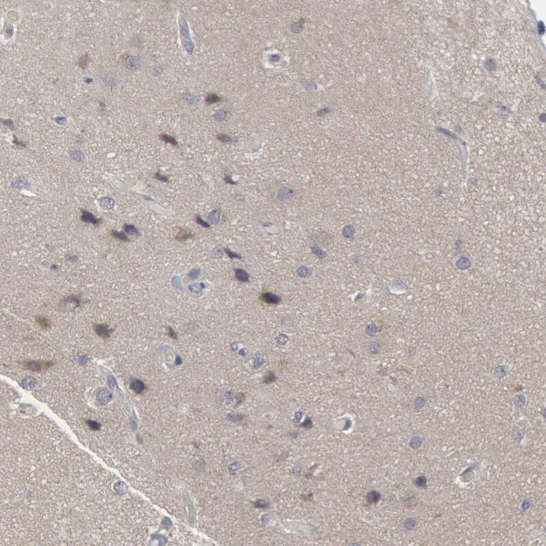 FoxO1/FKHR Antibody - BSA Free Immunohistochemistry-Paraffin: FoxO1/FKHR Antibody - BSA Free [NBP1-84674]