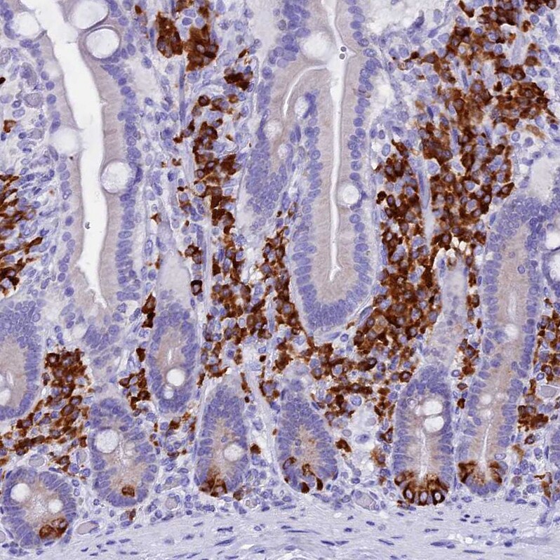 FKBP11 Antibody - BSA Free Immunohistochemistry-Paraffin: FKBP11 Antibody - BSA Free [NBP1-84678]
