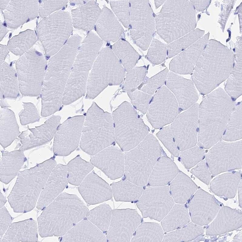FKBP11 Antibody - BSA Free Immunohistochemistry-Paraffin: FKBP11 Antibody - BSA Free [NBP1-84678]
