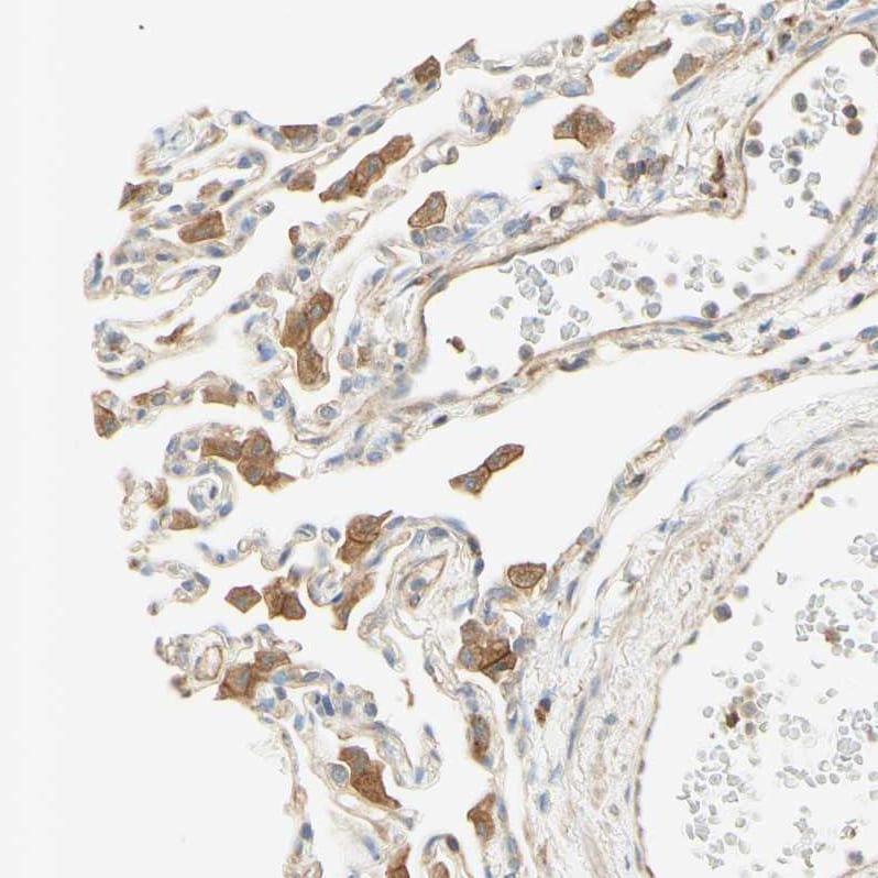 IKK gamma Antibody - BSA Free Immunohistochemistry-Paraffin: IKK gamma Antibody - BSA Free [NBP1-84681]