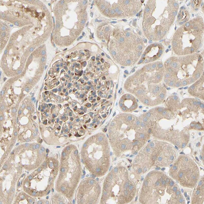 IKK gamma Antibody - BSA Free Immunohistochemistry-Paraffin: IKK gamma Antibody - BSA Free [NBP1-84681]