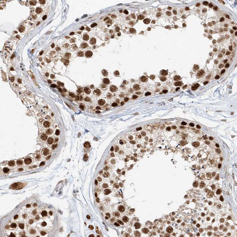 ZNF198 Antibody - BSA Free Immunohistochemistry-Paraffin: ZNF198 Antibody [NBP1-84685]