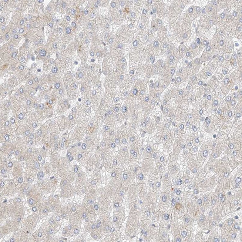 ZNF198 Antibody - BSA Free Immunohistochemistry-Paraffin: ZNF198 Antibody [NBP1-84685]