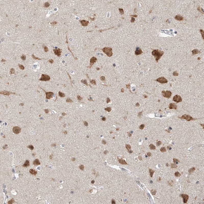 ZNF198 Antibody - BSA Free Immunohistochemistry-Paraffin: ZNF198 Antibody [NBP1-84685]