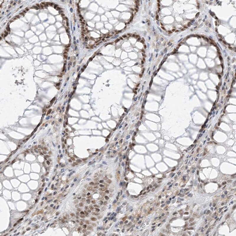 ZNF198 Antibody - BSA Free Immunohistochemistry-Paraffin: ZNF198 Antibody [NBP1-84685]