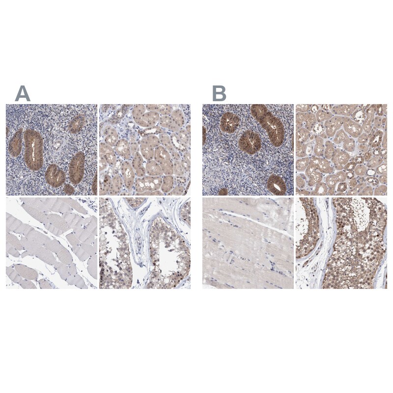 PURL Antibody - BSA Free Immunohistochemistry-Paraffin: PURL Antibody - BSA Free [NBP1-84691]