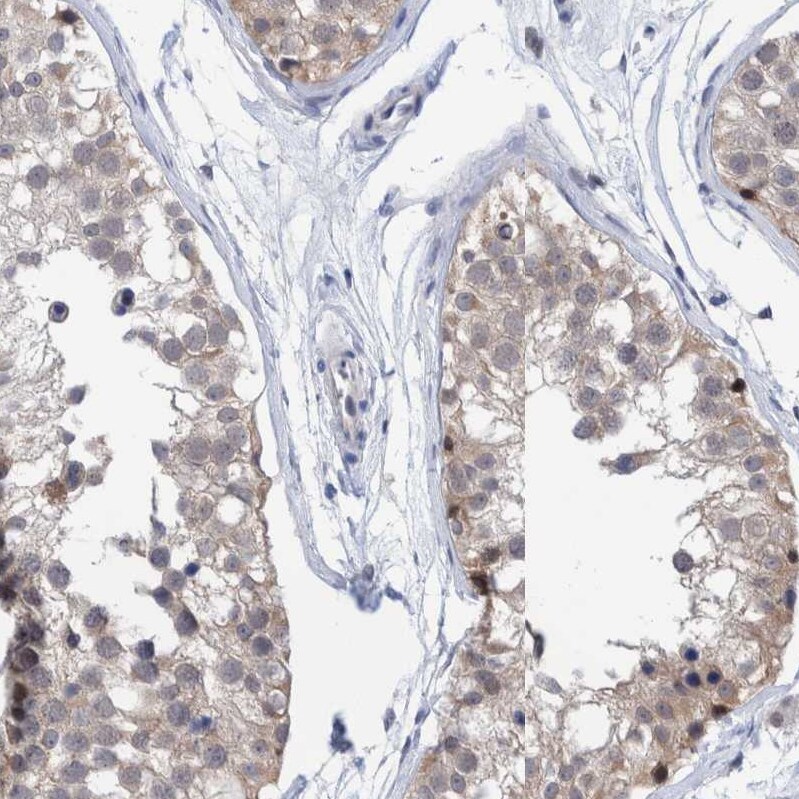 PURL Antibody - BSA Free Immunohistochemistry-Paraffin: PURL Antibody - BSA Free [NBP1-84691]
