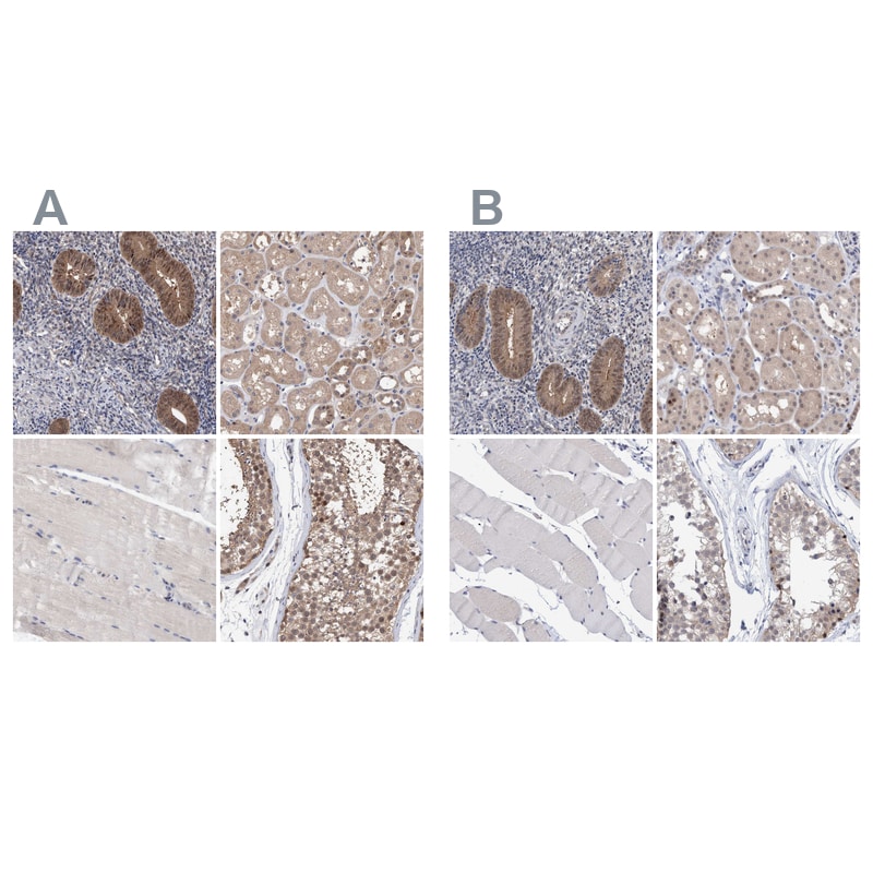 PURL Antibody - BSA Free Immunohistochemistry-Paraffin: PURL Antibody - BSA Free [NBP1-84692]