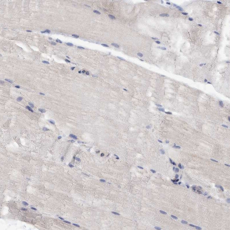 PURL Antibody - BSA Free Immunohistochemistry-Paraffin: PURL Antibody - BSA Free [NBP1-84692]