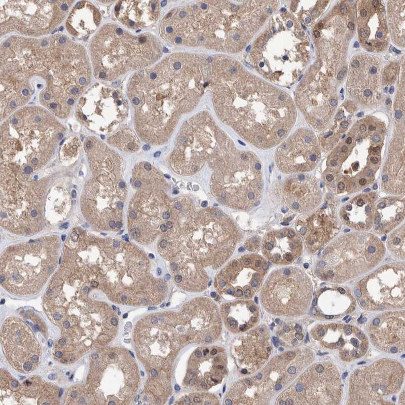 PURL Antibody - BSA Free Immunohistochemistry-Paraffin: PURL Antibody - BSA Free [NBP1-84692]