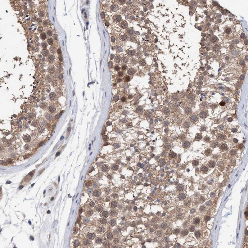 PURL Antibody - BSA Free Immunohistochemistry-Paraffin: PURL Antibody - BSA Free [NBP1-84692]