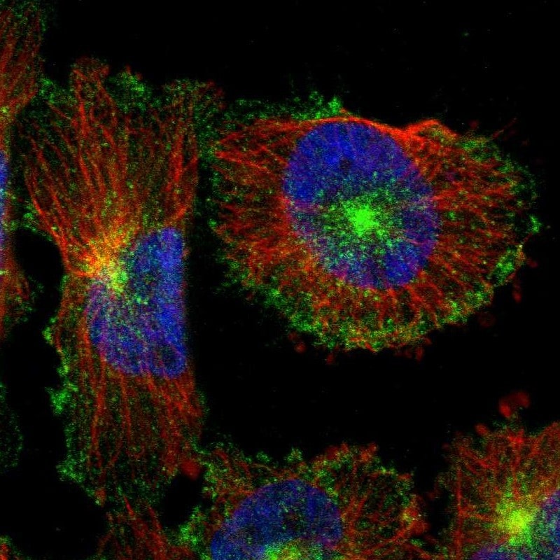 Myoferlin Antibody - BSA Free Immunocytochemistry/ Immunofluorescence: Myoferlin Antibody [NBP1-84694]