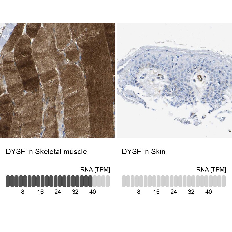 Dysferlin Antibody - BSA Free Immunohistochemistry-Paraffin: Dysferlin Antibody [NBP1-84696]