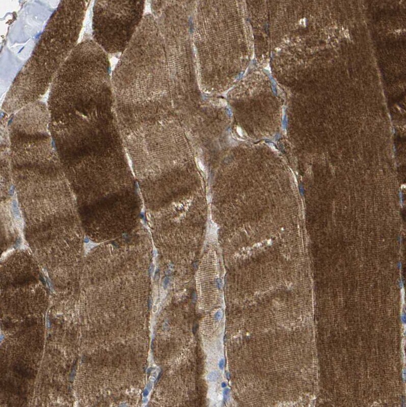 Dysferlin Antibody - BSA Free Immunohistochemistry-Paraffin: Dysferlin Antibody [NBP1-84696]