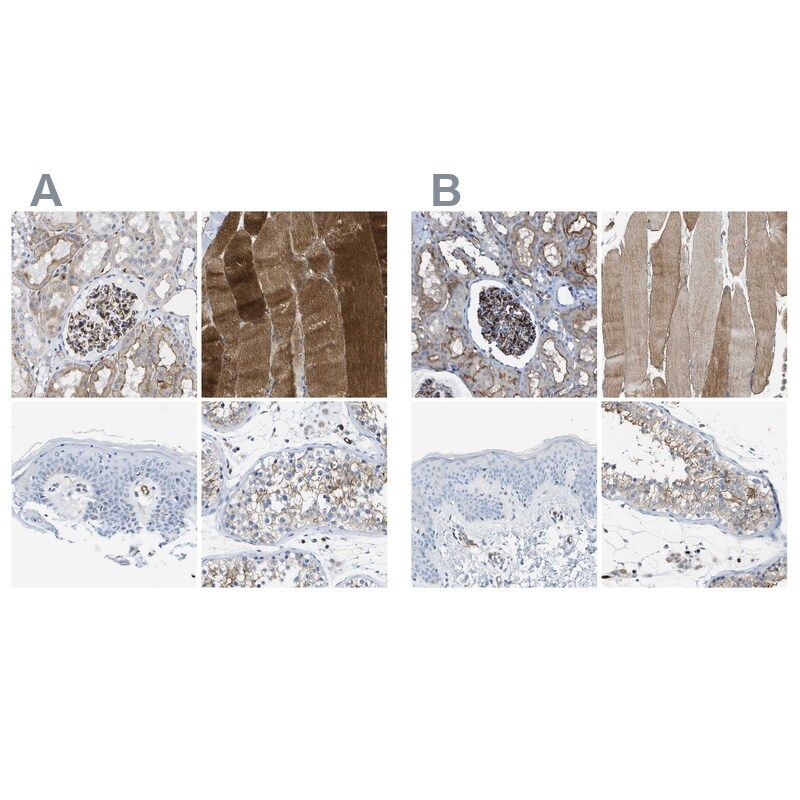 Dysferlin Antibody - BSA Free Immunohistochemistry-Paraffin: Dysferlin Antibody [NBP1-84696]