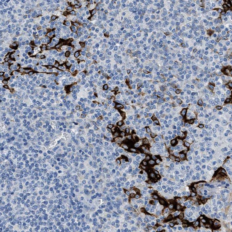 FDCSP Antibody - BSA Free Immunohistochemistry-Paraffin: FDCSP Antibody - BSA Free [NBP1-84702]