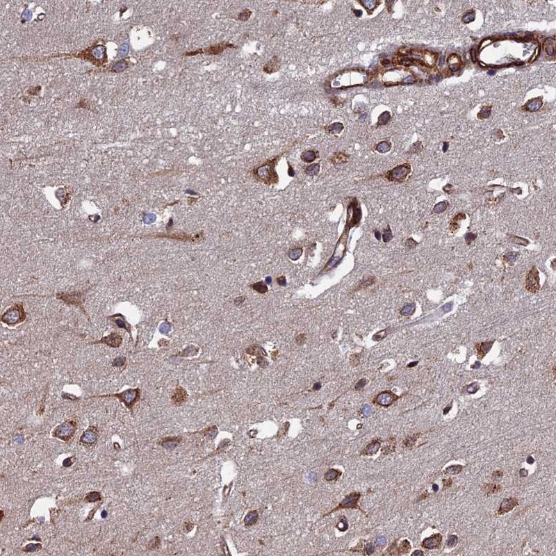 FCP1 Antibody - BSA Free Immunohistochemistry: FCP1 Antibody - BSA Free [NBP1-84704]