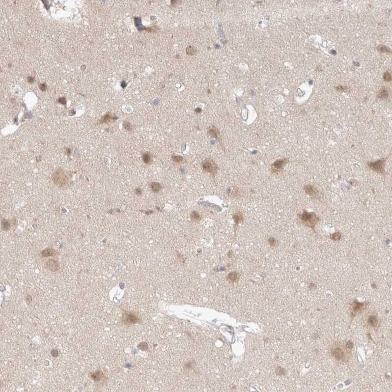 FBXO42 Antibody - BSA Free Immunohistochemistry-Paraffin: FBXO42 Antibody - BSA Free [NBP1-84711]