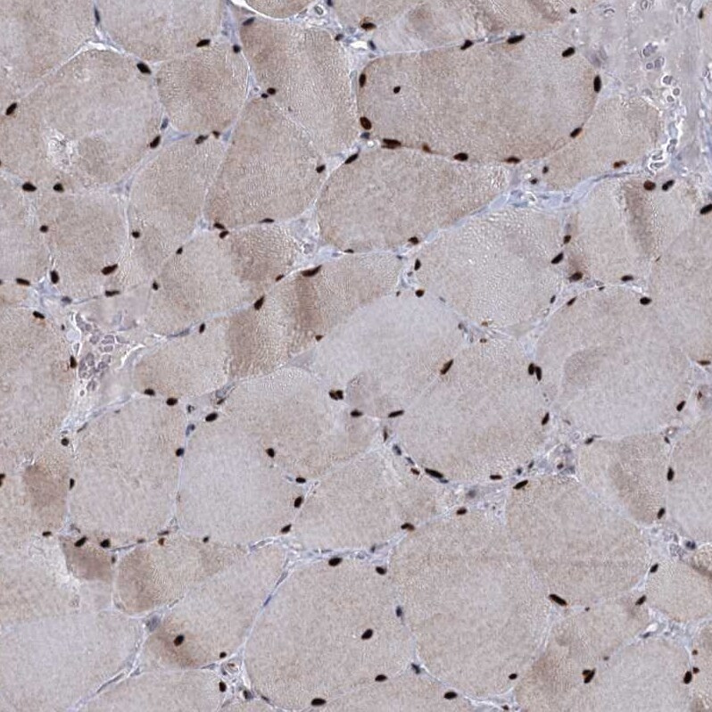 WBP4 Antibody - BSA Free Immunohistochemistry-Paraffin: WBP4 Antibody [NBP1-84718]