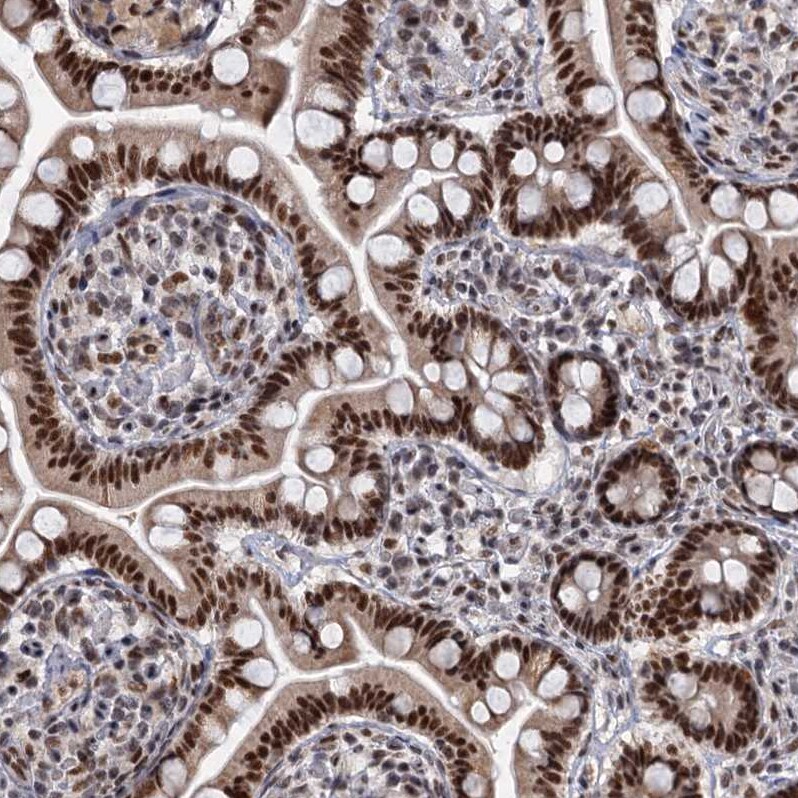 WBP4 Antibody - BSA Free Immunohistochemistry-Paraffin: WBP4 Antibody [NBP1-84718]