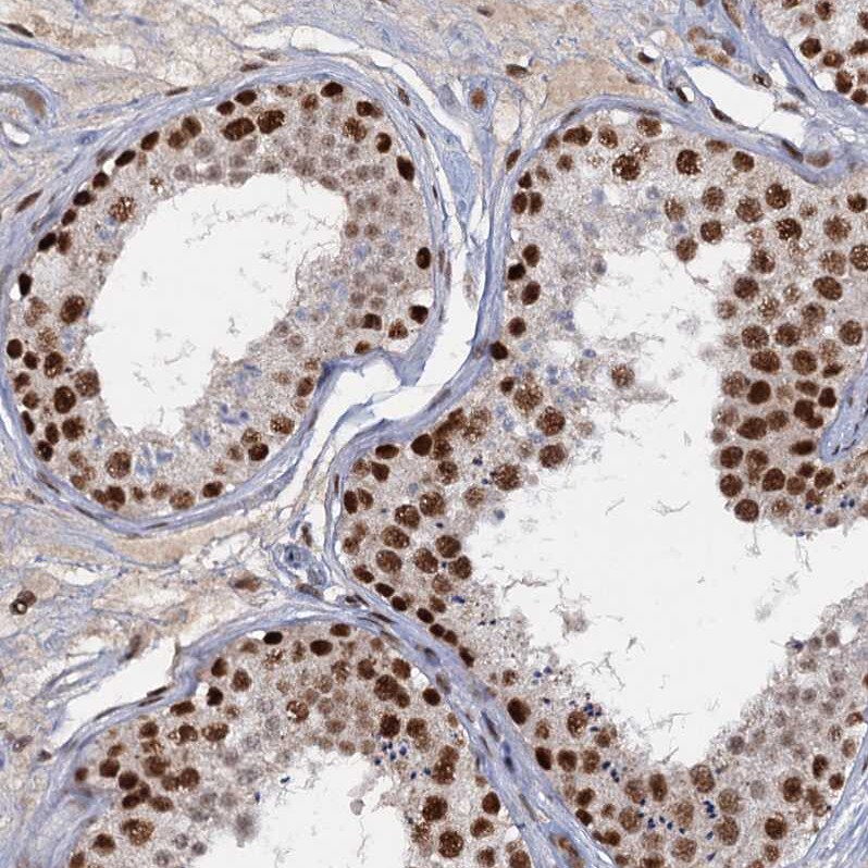 WBP4 Antibody - BSA Free Immunohistochemistry-Paraffin: WBP4 Antibody [NBP1-84718]