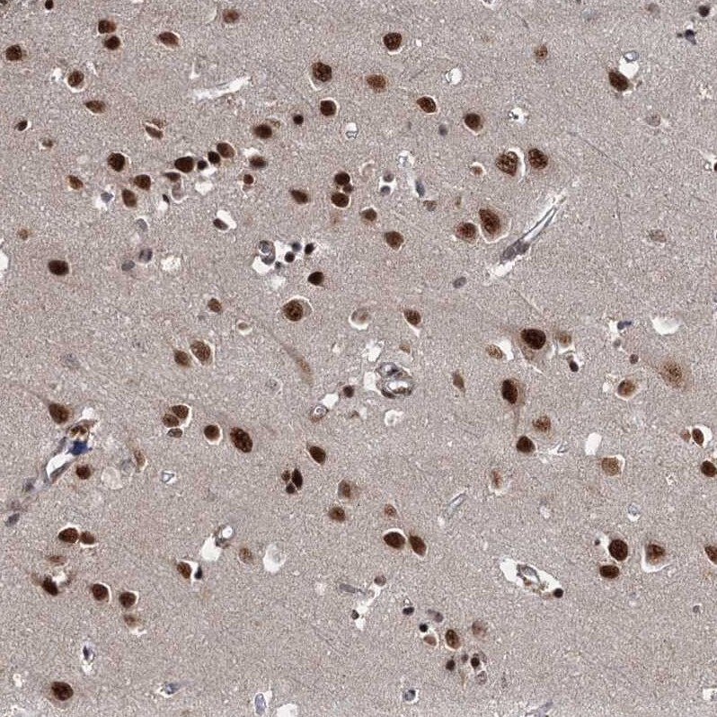 WBP4 Antibody - BSA Free Immunohistochemistry-Paraffin: WBP4 Antibody [NBP1-84718]