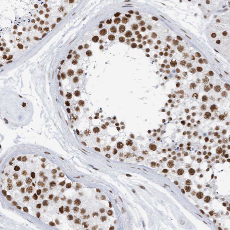 KHSRP Antibody - BSA Free Immunohistochemistry-Paraffin: KHSRP Antibody [NBP1-84719]