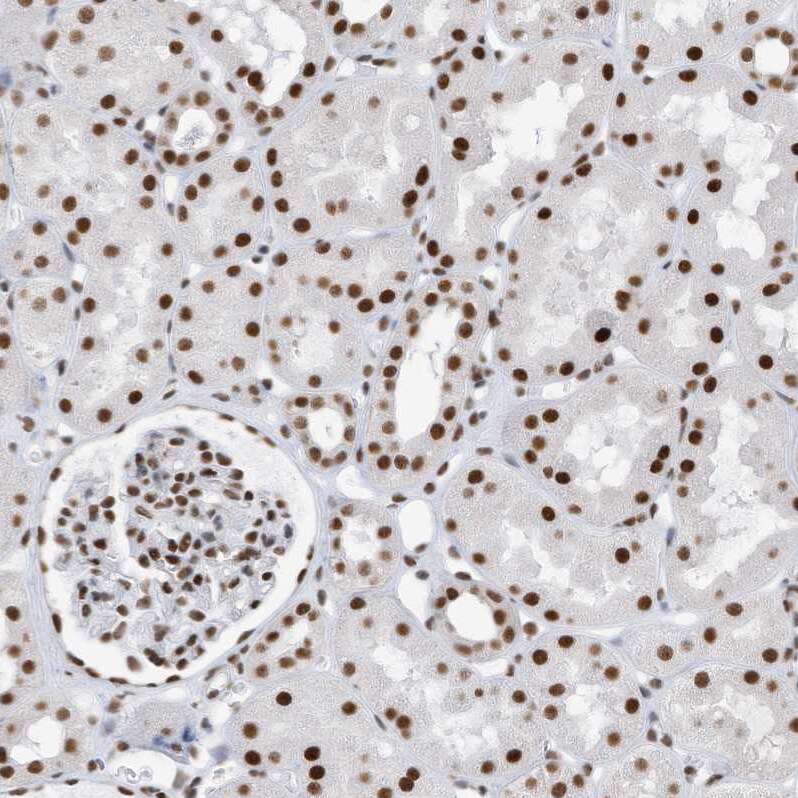 KHSRP Antibody - BSA Free Immunohistochemistry-Paraffin: KHSRP Antibody [NBP1-84719]