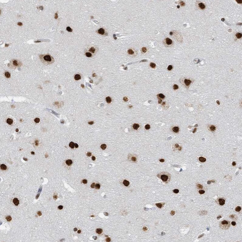 KHSRP Antibody - BSA Free Immunohistochemistry-Paraffin: KHSRP Antibody [NBP1-84719]