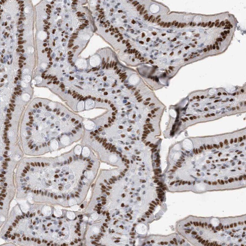 KHSRP Antibody - BSA Free Immunohistochemistry-Paraffin: KHSRP Antibody [NBP1-84719]