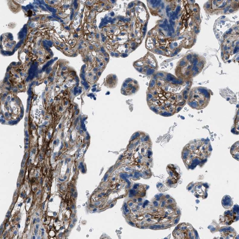 Fibrillin 1 Antibody - BSA Free Immunohistochemistry-Paraffin: Fibrillin 1 Antibody - BSA Free [NBP1-84723]