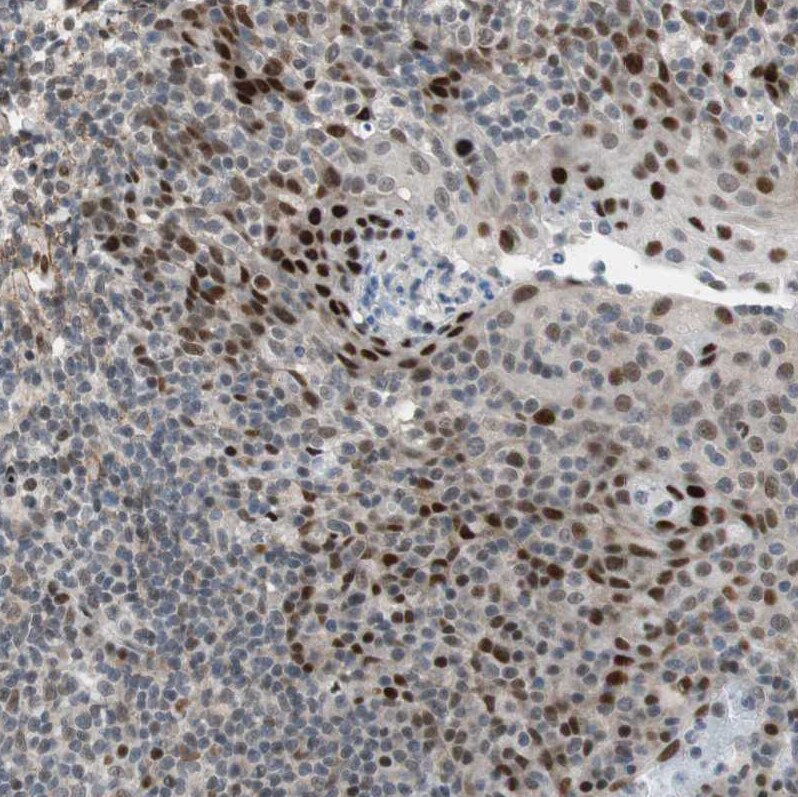 FBXO44 Antibody - BSA Free Immunohistochemistry-Paraffin: FBXO44 Antibody [NBP1-84728]