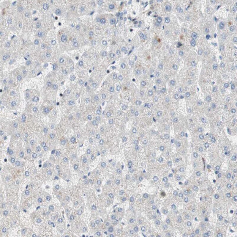 FBXO44 Antibody - BSA Free Immunohistochemistry-Paraffin: FBXO44 Antibody [NBP1-84728]