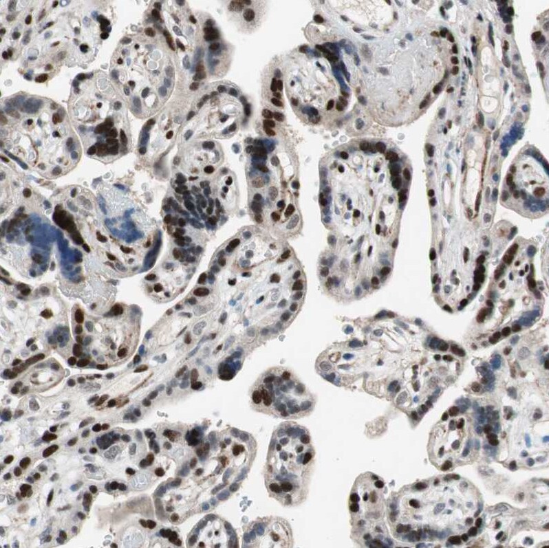 FBXO44 Antibody - BSA Free Immunohistochemistry-Paraffin: FBXO44 Antibody [NBP1-84728]