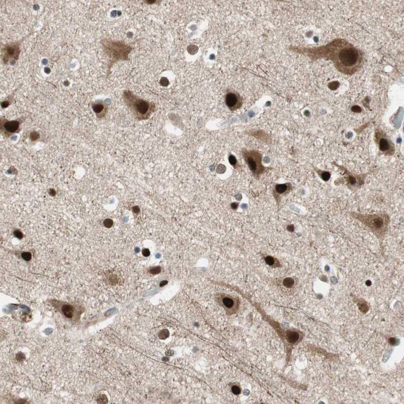 FBXO44 Antibody - BSA Free Immunohistochemistry-Paraffin: FBXO44 Antibody [NBP1-84728]