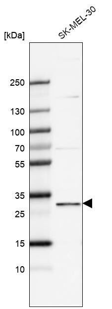 FBXO44 Antibody - BSA Free Western Blot: FBXO44 Antibody - BSA Free [NBP1-84728]