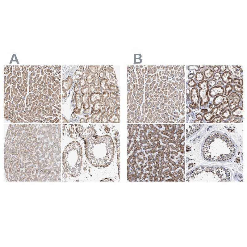 OXSM Antibody - BSA Free Immunohistochemistry-Paraffin: OXSM Antibody - BSA Free [NBP1-84732]