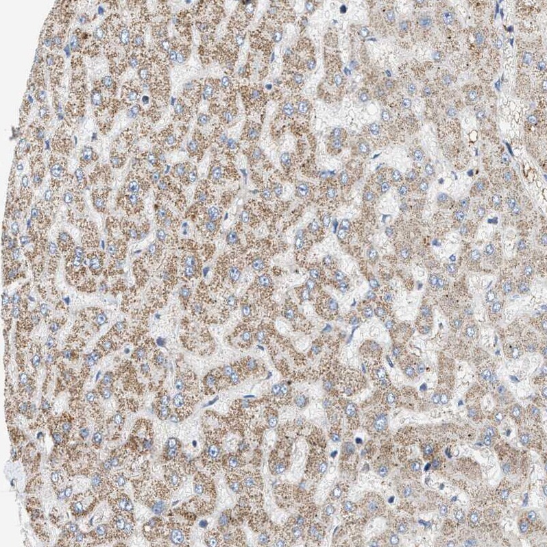 OXSM Antibody - BSA Free Immunohistochemistry-Paraffin: OXSM Antibody - BSA Free [NBP1-84732]