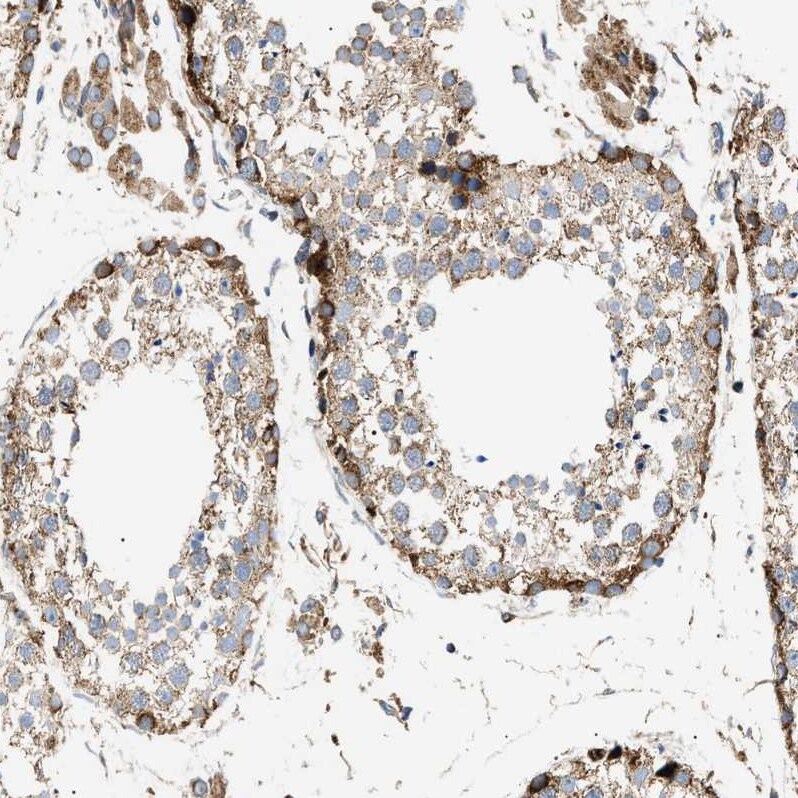 OXSM Antibody - BSA Free Immunohistochemistry-Paraffin: OXSM Antibody - BSA Free [NBP1-84732]
