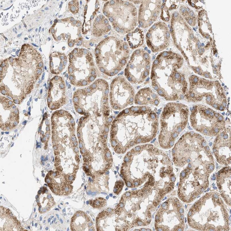 OXSM Antibody - BSA Free Immunohistochemistry-Paraffin: OXSM Antibody - BSA Free [NBP1-84732]