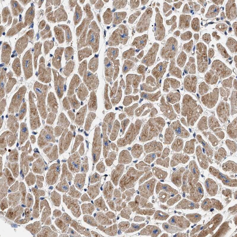 OXSM Antibody - BSA Free Immunohistochemistry-Paraffin: OXSM Antibody - BSA Free [NBP1-84732]