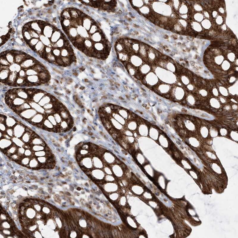 CLUAP1 Antibody - BSA Free Immunohistochemistry: CLUAP1 Antibody - BSA Free [NBP1-84734]