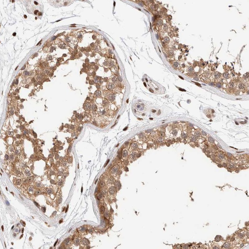 NSMAF Antibody - BSA Free Immunohistochemistry-Paraffin: NSMAF Antibody - BSA Free [NBP1-84735]