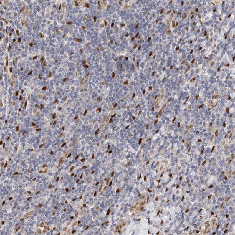 NSMAF Antibody - BSA Free Immunohistochemistry-Paraffin: NSMAF Antibody - BSA Free [NBP1-84735]