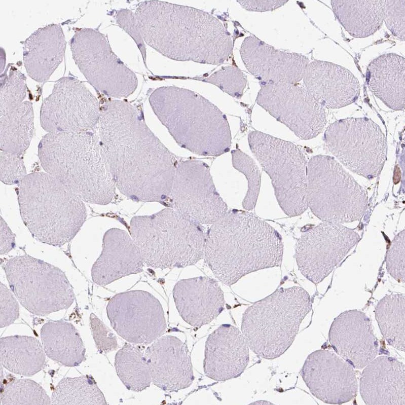 PTPIP51 Antibody - BSA Free Immunohistochemistry-Paraffin: PTPIP51 Antibody - BSA Free [NBP1-84738]