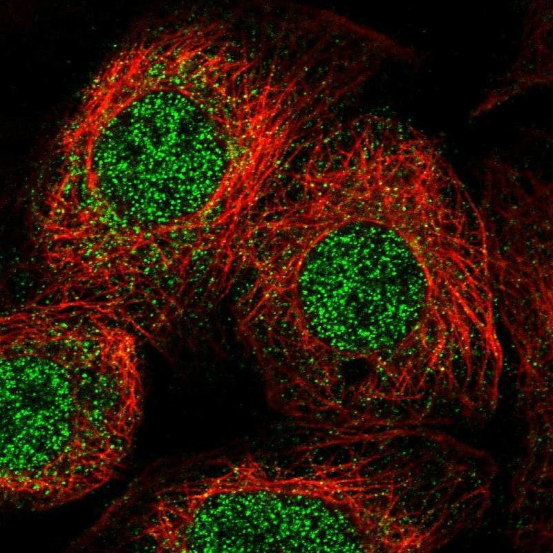ULK4 Antibody - BSA Free Immunocytochemistry/ Immunofluorescence: ULK4 Antibody [NBP1-84739]