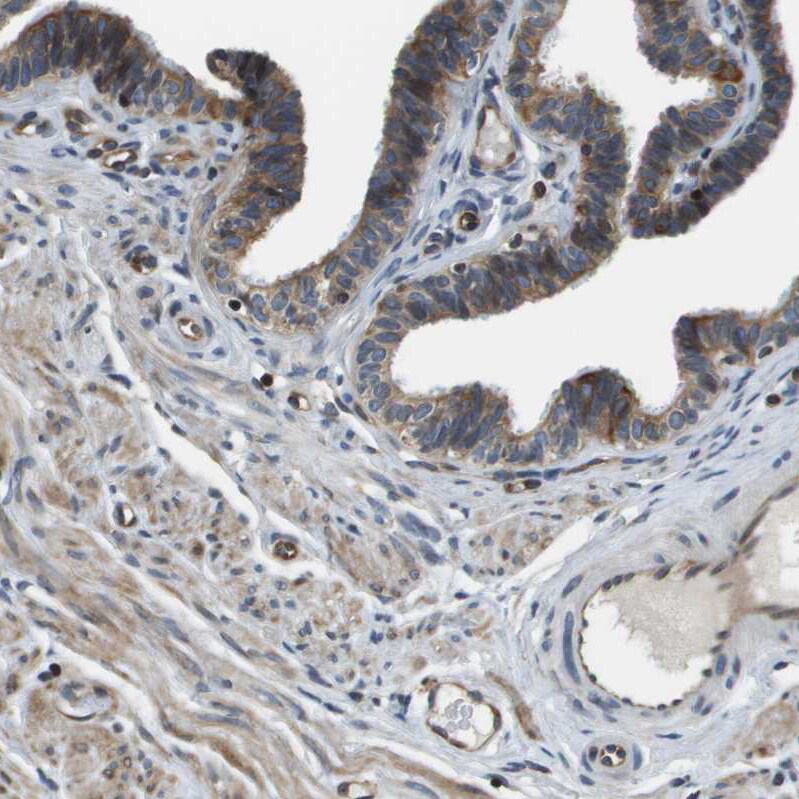 FAM62A Antibody - BSA Free Immunohistochemistry-Paraffin: FAM62A Antibody - BSA Free [NBP1-84741]